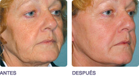 Imágenes cortesía: Dr. James Chan