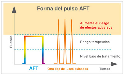 Forma-del-pulso-tecnologia-luz-aft