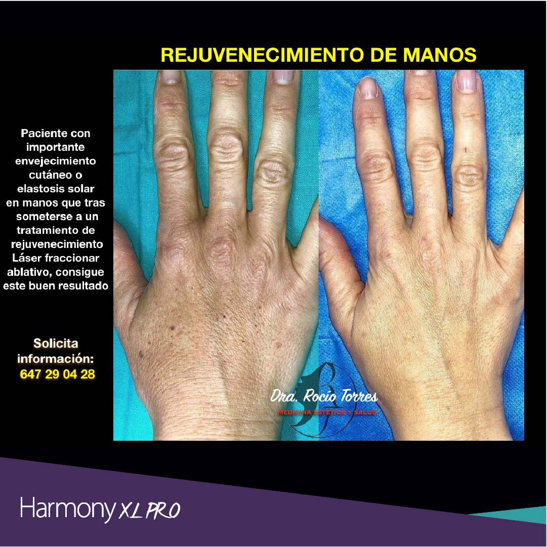 harmony xl pro y dra rocio torres-05