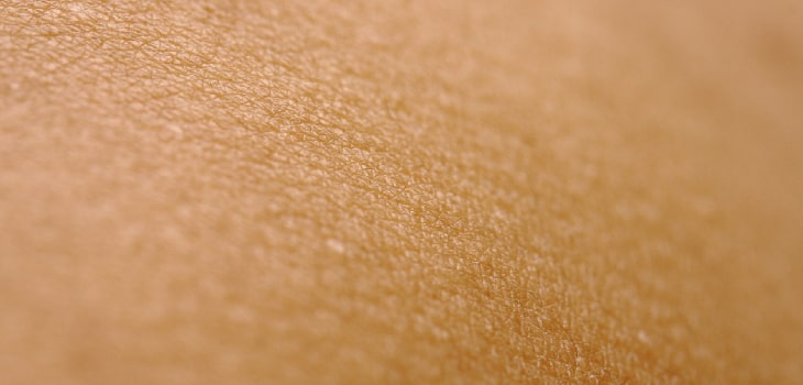¿Qué es un dermatólogo y qué hace?