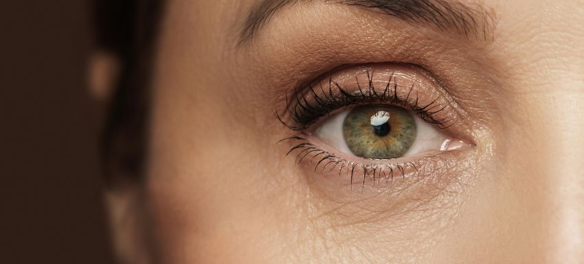 ¿Cómo se pueden quitar las arrugas de los ojos?