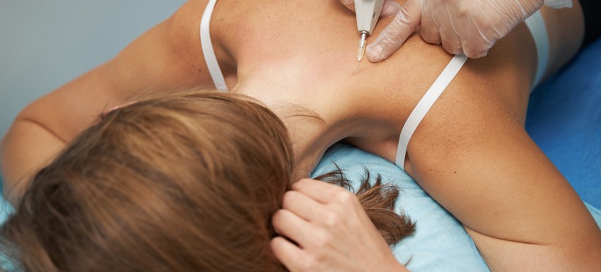 Carboxiterapia o cavitación: ¿Qué es mejor en cada caso?