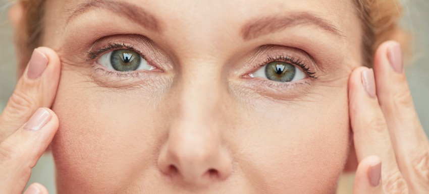¿Cómo eliminar las patas de gallo en los ojos?