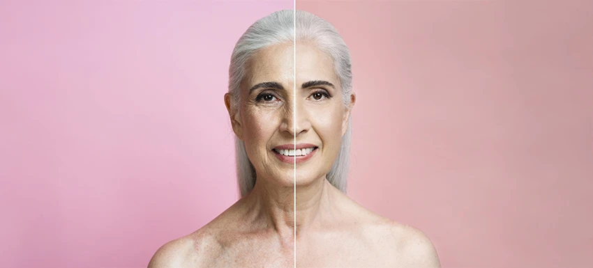 Nuevos protocolos en medicina estética: innovaciones en blefaroplastia, rejuvenecimiento peribucal, ojeras, acné…