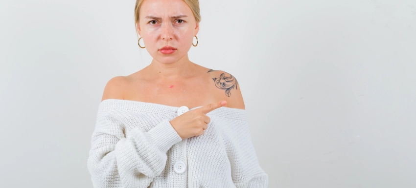 ¿Cómo puedo borrar un tatuaje sin láser?
