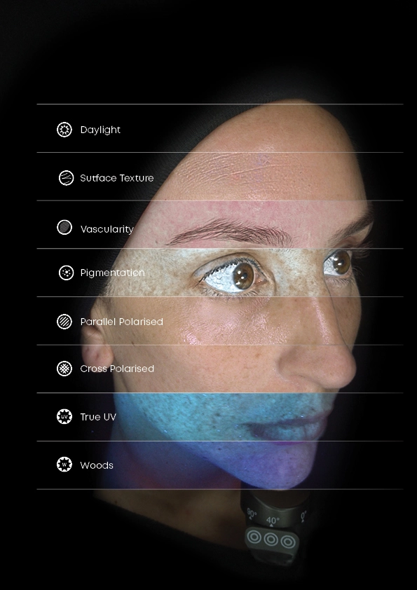 Imagen de un rostro femenino en primer plano dividido en franjas horizontales que muestran diferentes modos de análisis cutáneo, como luz diurna, textura, vascularidad, pigmentación, polarización, UV verdadero y Woods.