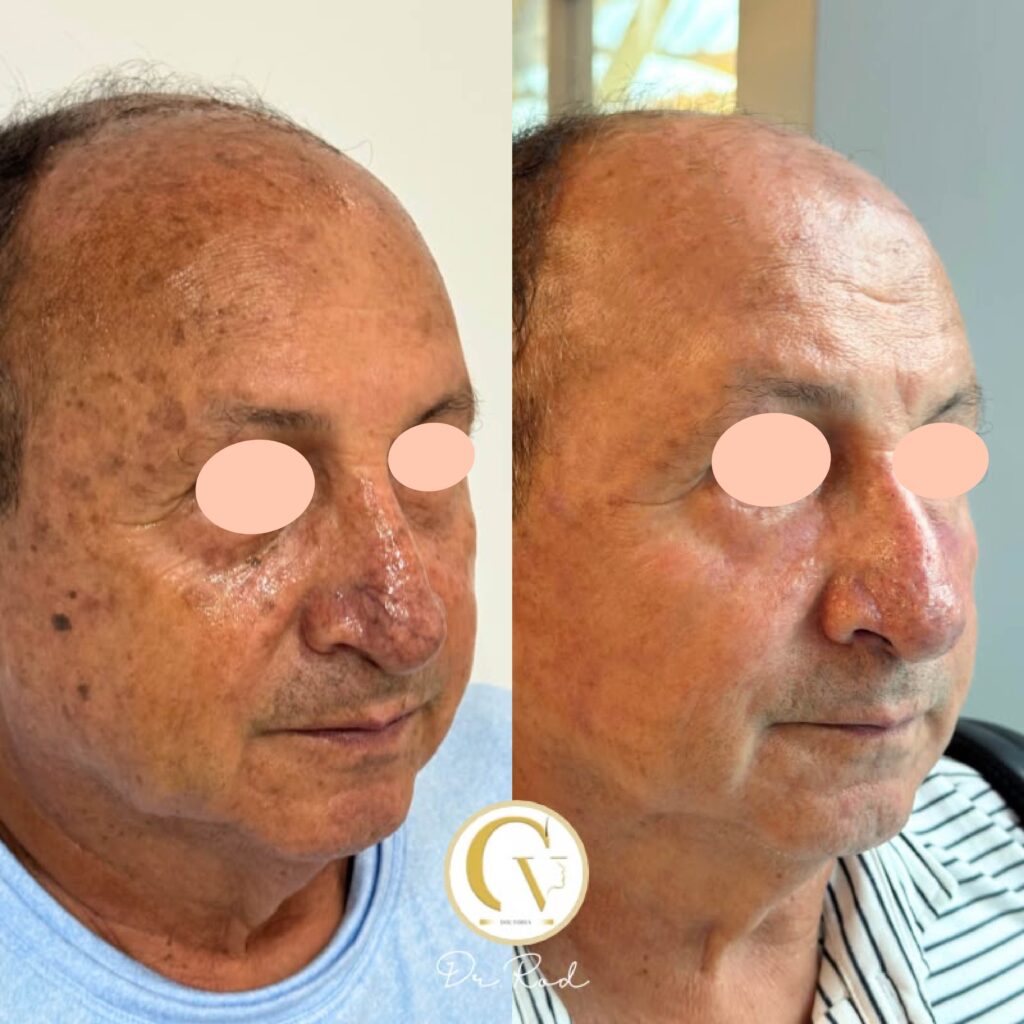 caso antes y despues rodolfo chicas
